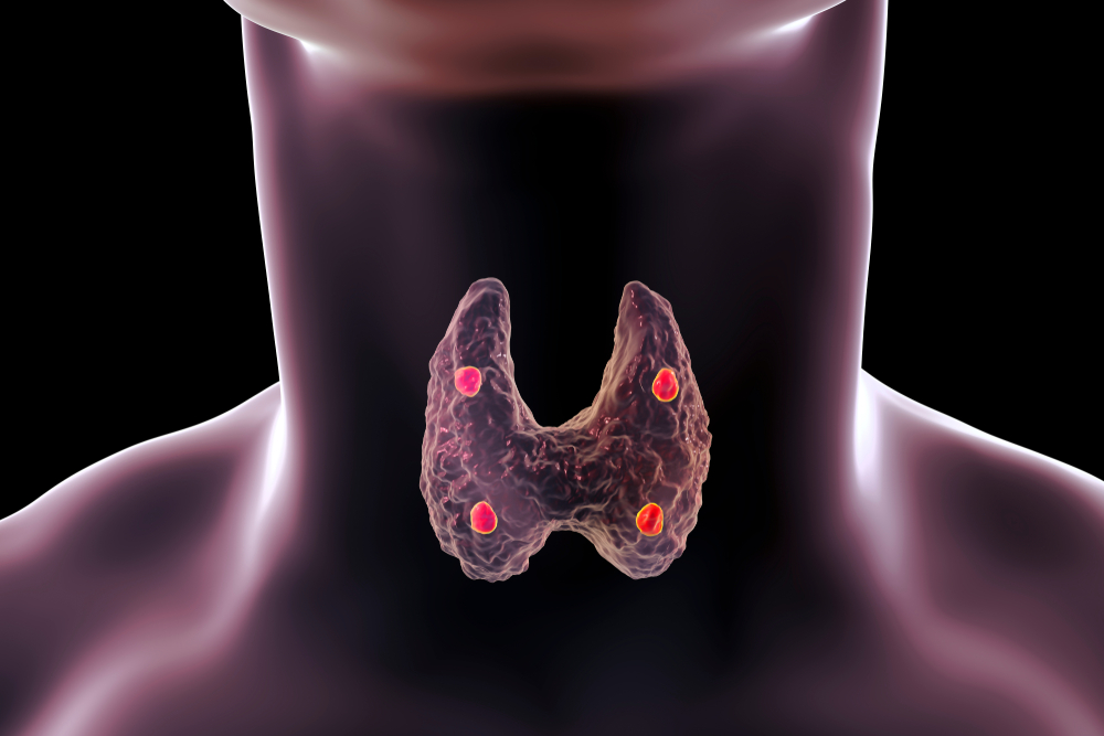 6 Lifelong Benefits of Natural Thyroid Activators